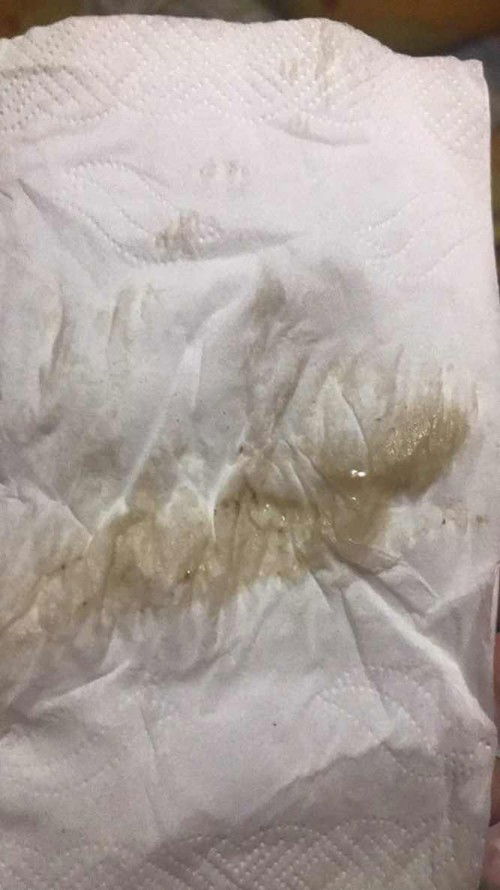 แบบนี้ต้องไปหาหมอมั้ยคะ