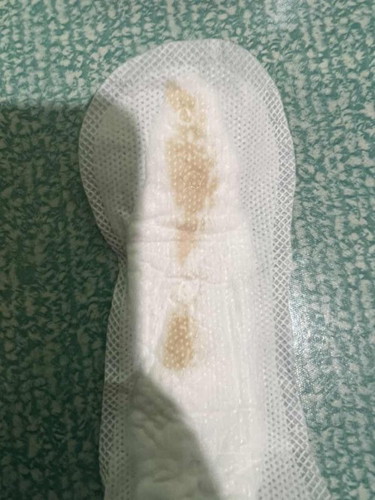 Hello mga mi ano po kayo to? it is normal po ba? FTM here