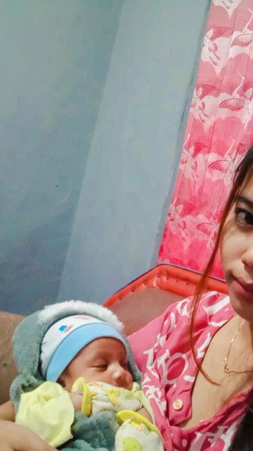 Jahitan lepas 5 hari pascamelahirkan