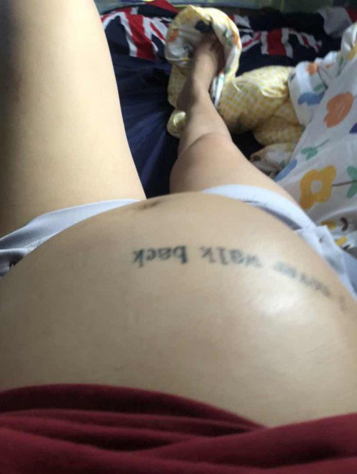 ลูก34week ท้องแข็งบ่อย