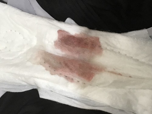 แบบนี้คือเลือดล้างหน้าเด็กหรือป่าวคะ