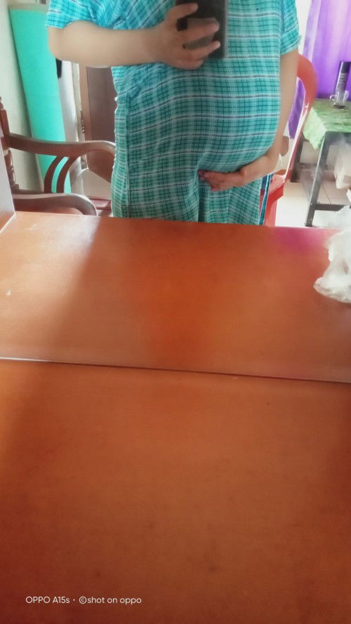 Bun BB janin 1.1 dgn usia kandungan 27 week 6 d