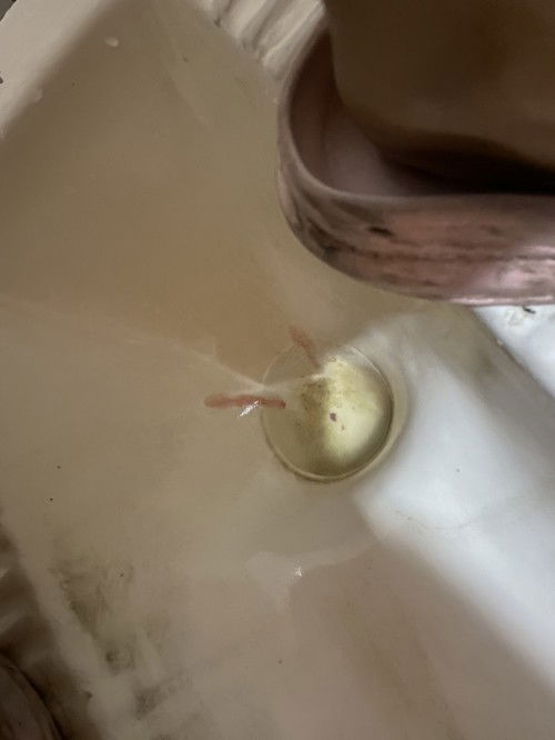 อายุครรภ์2เดือนมีเลือดไหล