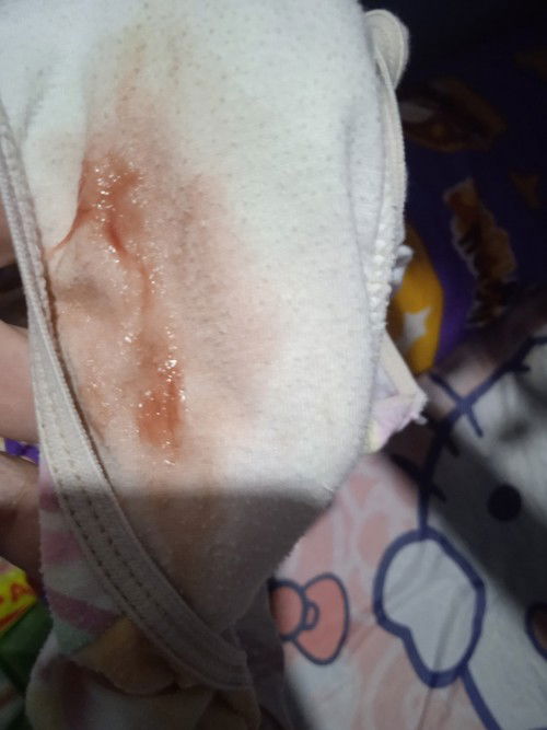 40weeks pregnant cno po nkaranas ng ganito sumasakit tyan ko at balakang pero hihinto nman agad