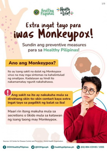 Impormasyon tungkol sa Monkeypox ayon sa DOH