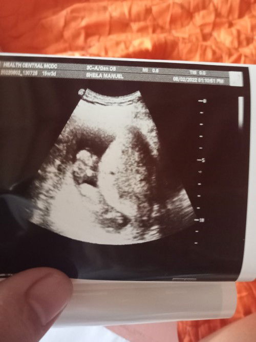 Ngcocontrast yung matress