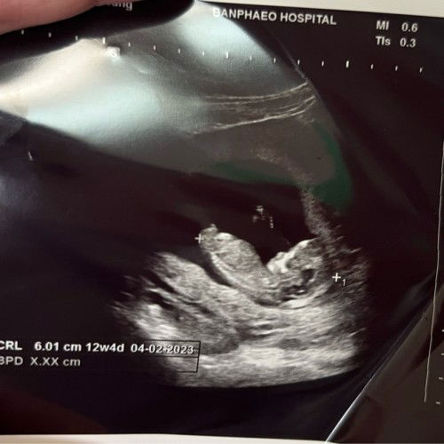 ทีมคุณแม่กุมภาพันธ์ 2566 👶👶