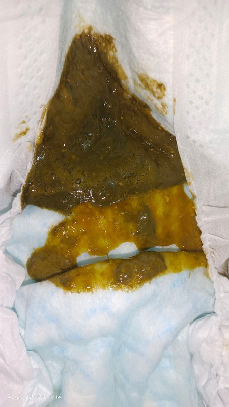 ITIM ITIM SA PUPU 4MONTHS BABY