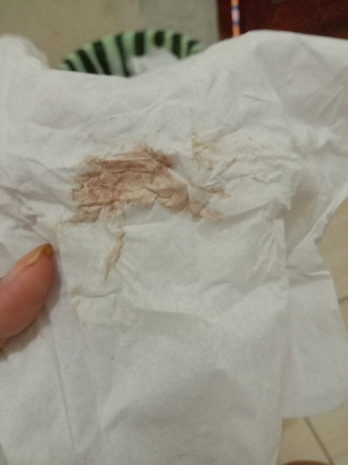 keputihan berwarna coklat muda saat hamil trimester kedua