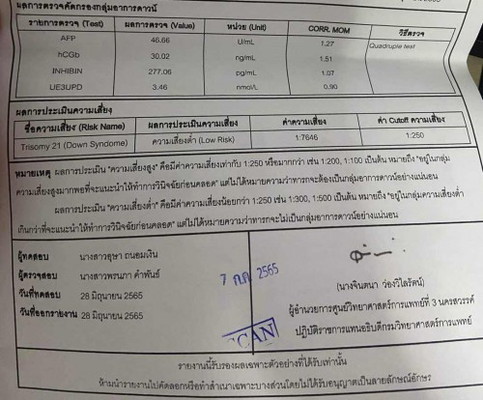 ตรวจดาวซินโดรม