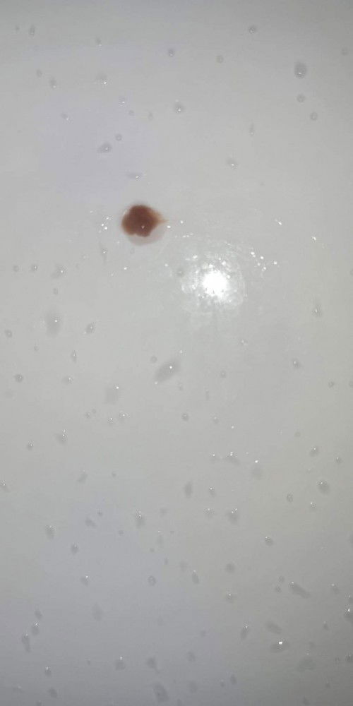 ใครเป็นบ้างค่ะ