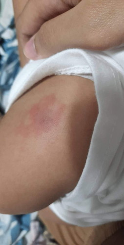 6in1 vaccine