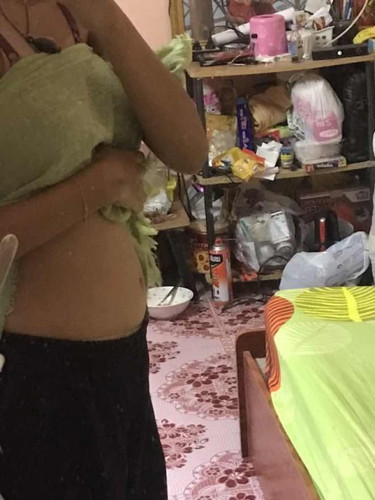 อาการคนตั้งครรภ์