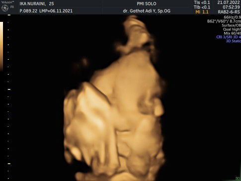 Mauu tanya dongs bun