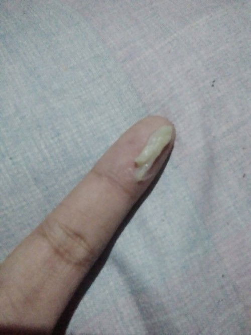 Mucus plug napo ba ito?
I'm 37 weeks and 3 days preggy. Sana mapansin..