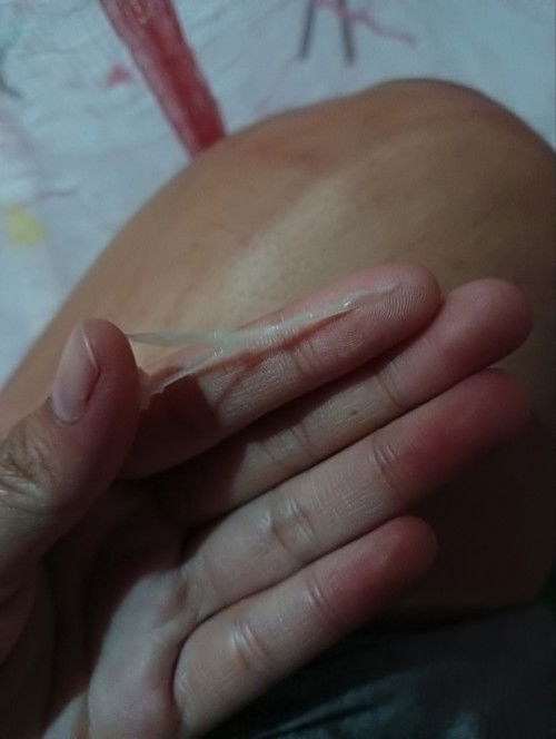 Hello mommies 25weeks napo ako ano kaya itong lumabas saakin? After umihi?