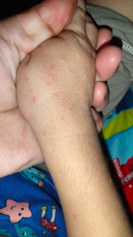 makati at may tumutubo