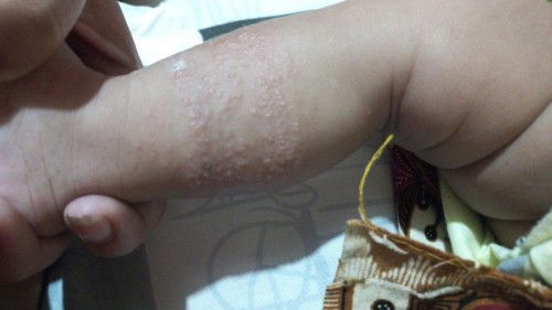 Minta solusi nya bun..