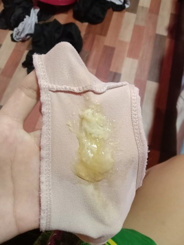 มีแบบนี้ไหลออกมาควรไปหาหมอไหมคะ