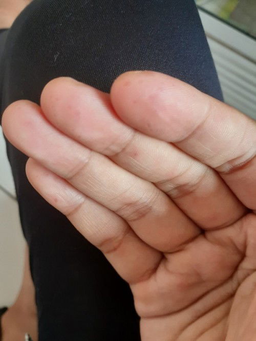 Saat jalan seperti tertusuk jarum