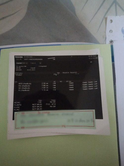 ขอรูปอัลตร้าซาวด์จากคุณหมอ