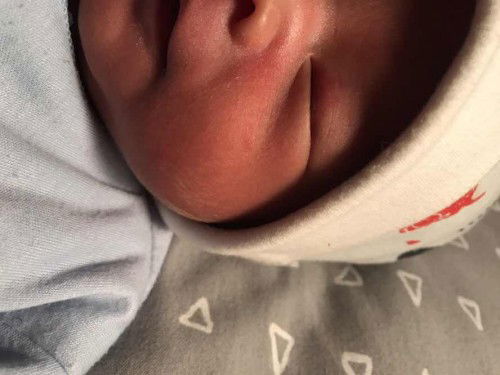 Bintik  merah kadang ada bintik putihnya