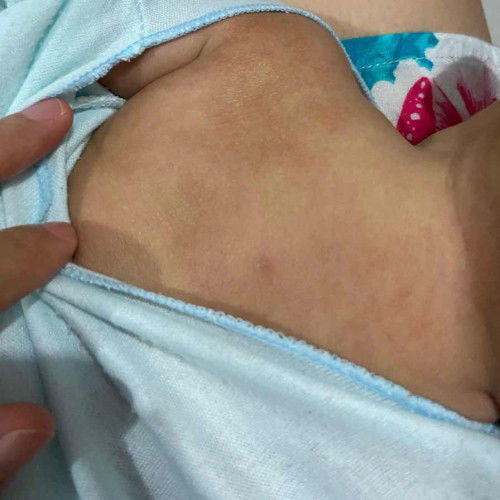 Kulit bayi kering menghitam