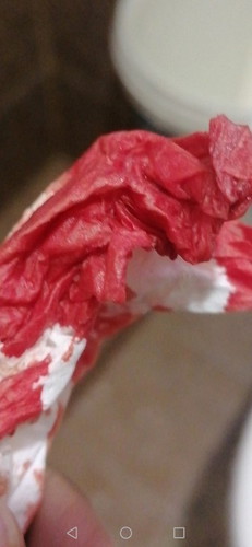 Im 7 weeks suddenly over bleeding, ist normal