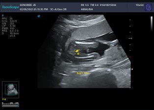 hy mummy2 sume nk cube tgk btul ke ni girl..