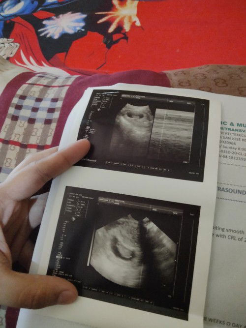 Non stop Discharge Yellow/Brown