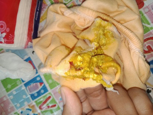 Feses bayi 3 bulan 12 hari