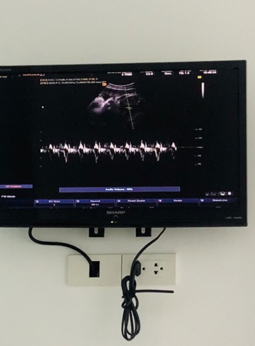 เเม่ๆส่วนใหญ่เเตกตอนกี่วีคคะ บ้านนี้ 40 week เเล้วยังไม่มีอาการอะไรเลย