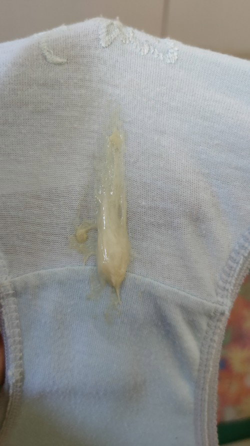 Ganito po ba ang Mucus Plug?
