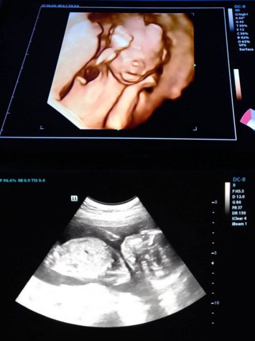 ทีมเสือสาว ธันวาคม 65