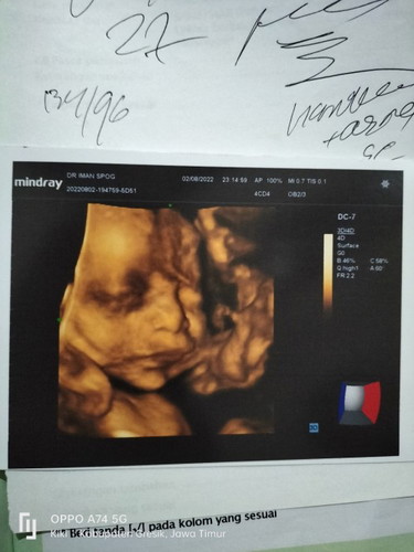 Bunda mau bertanya apakah Kehamilan 27 week janin dalam perut bisa kentut ??