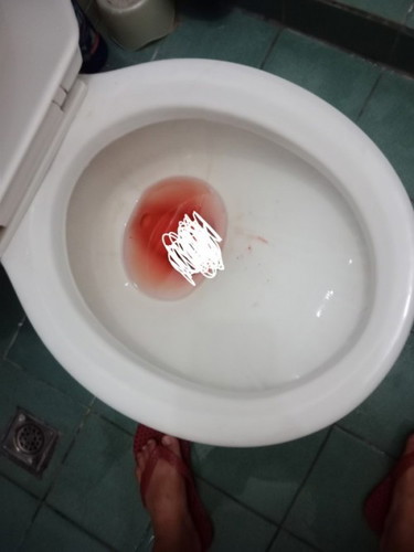 Dugo sa pupu