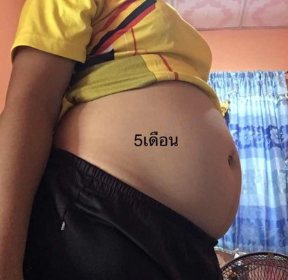 เจ็บหัวหน่าว เชิงกราน