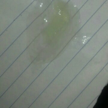 Keluar lendir bening+putih saat hamil 40w3d.Apakah termasuk tanda persalinan ya bund ?mohon infonya