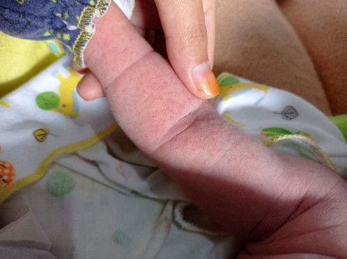 Buang keringat di tangan 🥺