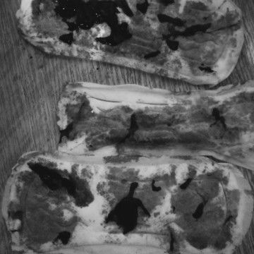 2months heavy bleeding