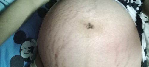 Masama bang maglinis ng pusod kapag buntis?