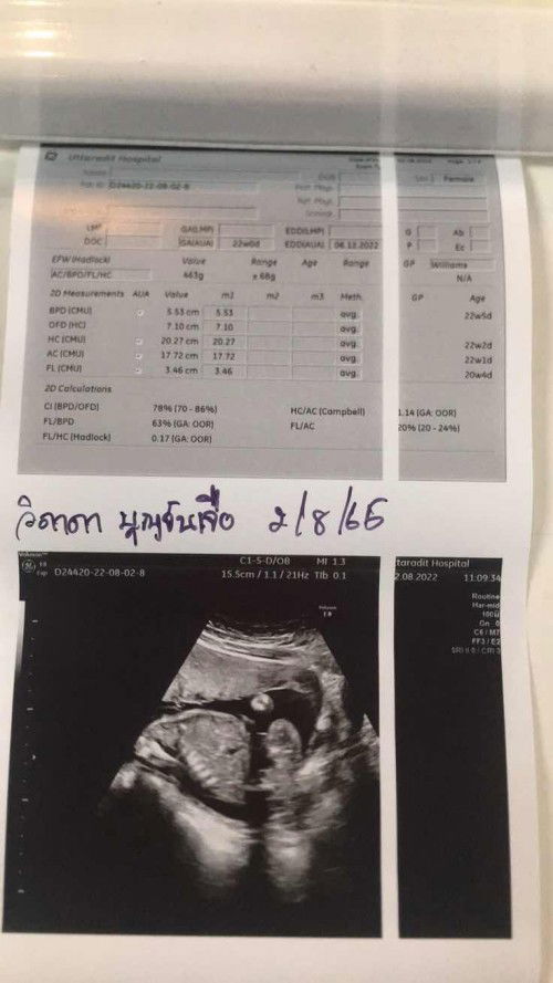 แม่ๆๆว่าน้องเป้น ผู้ชายแน่ไหม