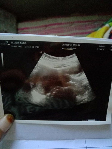 Bun. Ini hasil usg 4w yg lalu. Kta dokter blm ada apa" .. Skrng sudah masuk 11w 2d jadi tkut mau usg