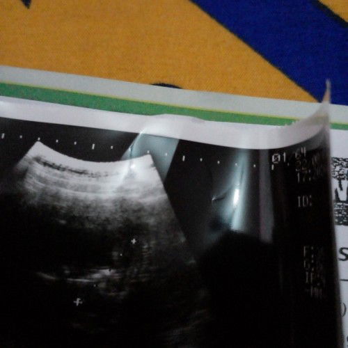 Usia kehamilan saya 11minggu 5 hari