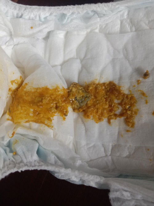 Bé 4 tháng tuổi hay bị đau bụng thì có sao không ạ