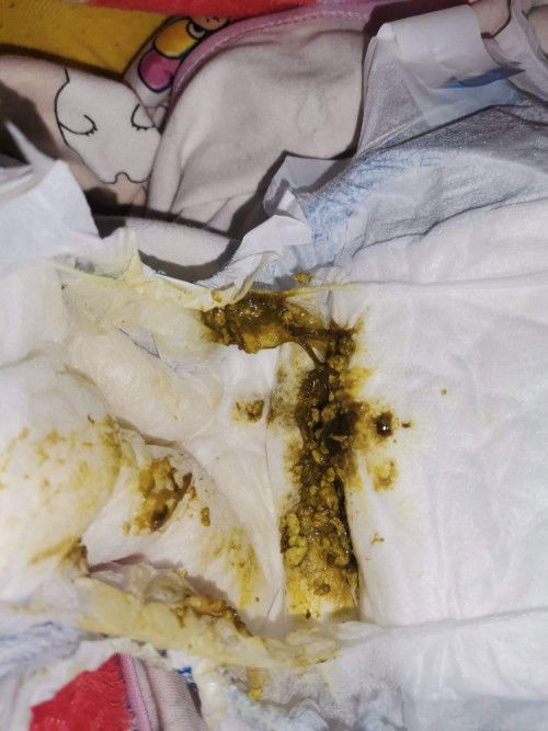 Mga mommy natural lang po ito sa newborn baby Yung ganitong dumi?