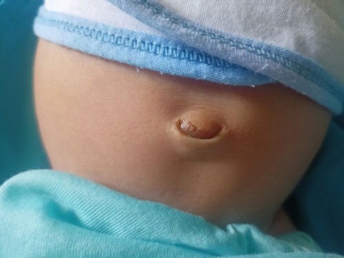 Pusod ni baby