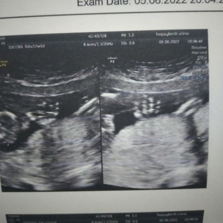 บ้านนี้ได้ลูกชาย 17w