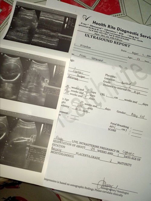 Hi mommies tanong ko lang po kung anong ibig sabihin ng distance to internal os : high?