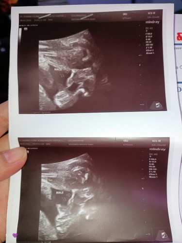 Confirm gender ?